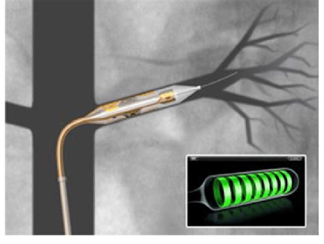 Vessix Renal Denervation Balloon Catheter With Two Pairs Of Bipolar Download Scientific Diagram