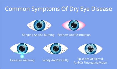 COMLY EYE CARE — Understanding Dry Eye: Causes, Symptoms, and Treatments