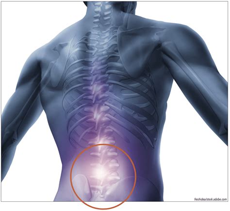 Lumbar Back Pain Into Legs