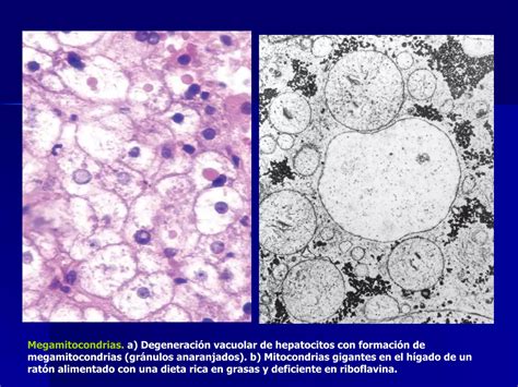 Lesiones Reversibles E Irreversibles Ppt