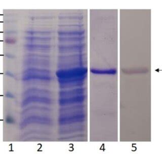 Expression Purification And Analysis Of Bp Protein Lane Shows