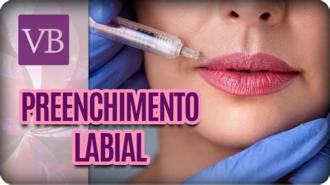 Preenchimento Labial Você Bonita 28 11 17 Youtube