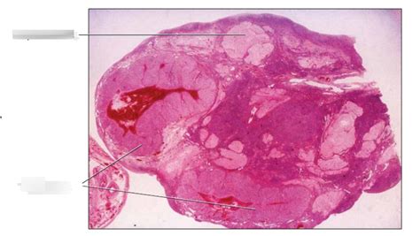 Ovary With Corpus Luteum And Corpus Albicans Diagram Quizlet