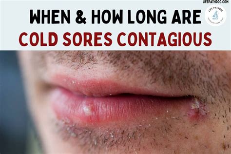 When How Long Are Cold Sores Contagious And Its Spread