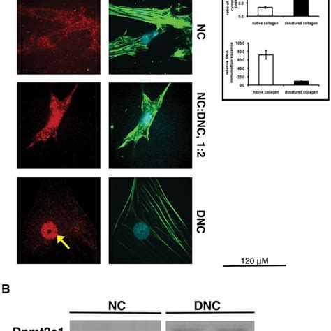 DNMT3A Expression Is Inhibited By ERK And F11 Inhibitors On DNC The