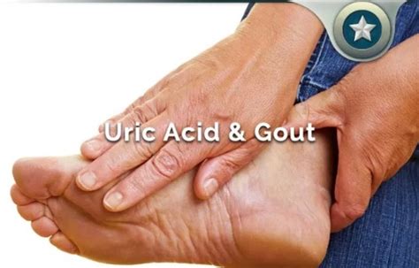 Uric Acid Signs Causes Symptoms And Treatment Healthy Solutions