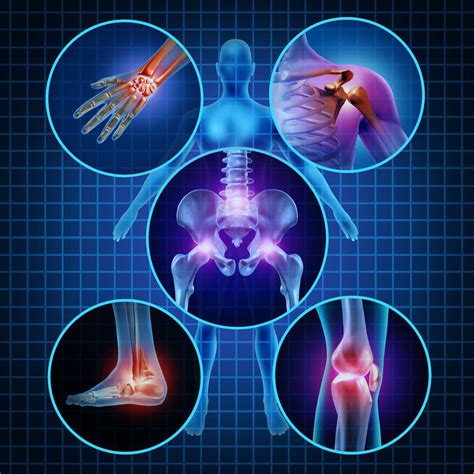 Arthritis And Stem Cells Cells4Life