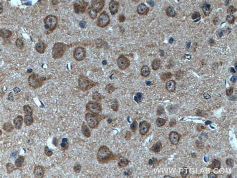 CYFIP1 2 antibody 16011 1 AP Proteintech 武汉三鹰生物技术有限公司