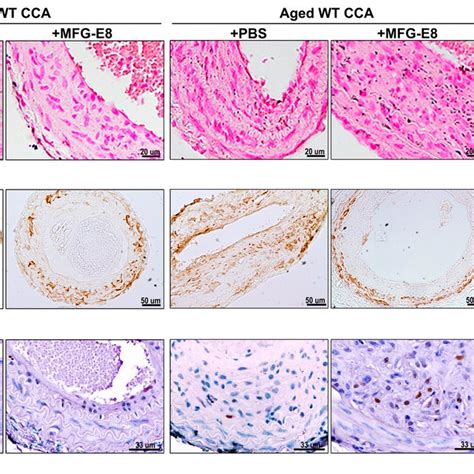 Milk Fat Globule Epidermal Growth Factor 8 Mfg E8 Deficiency Download Scientific Diagram