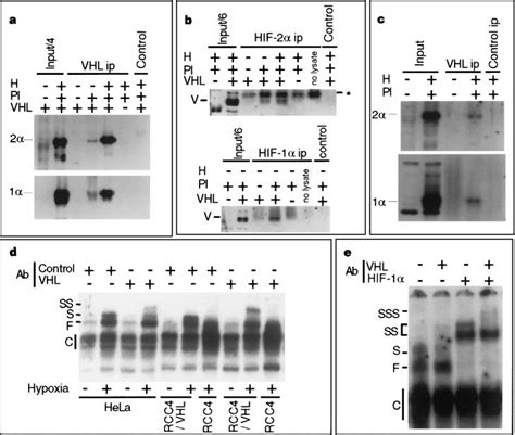 Association Of PVHL With HIF 1 A Immunoblots For HIF Subunits 2 1