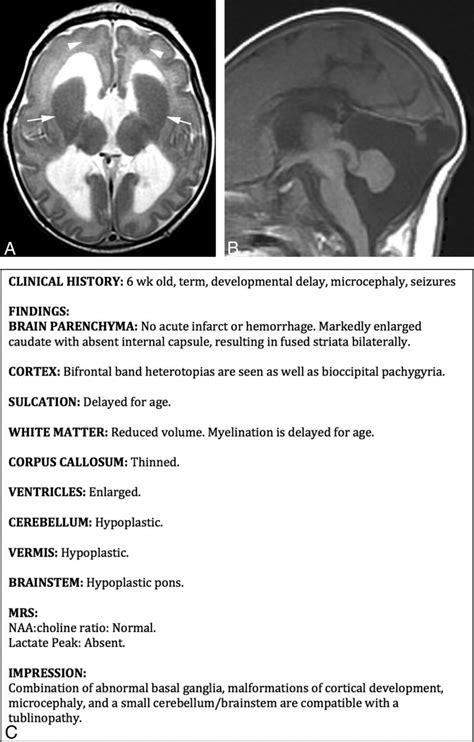 Report Radiology Template Cbct Case Format Guidelines Pdf X Ray In