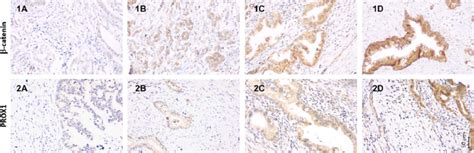 The Immunohistochemical Staining Pattern Of Catenin And Prox1 In Download Scientific Diagram