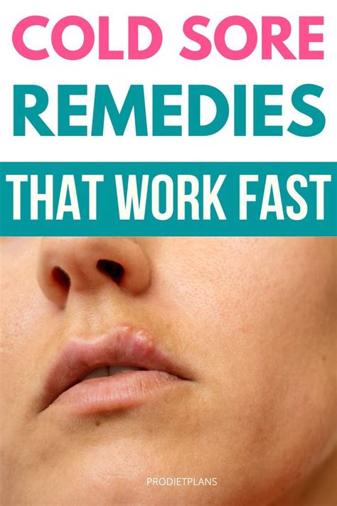 Get rid of cold sore 11 natural cold sore remedies that work – Artofit