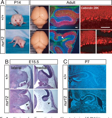 Figure 1 From Zfp423 Controls Proliferation And Differentiation Of