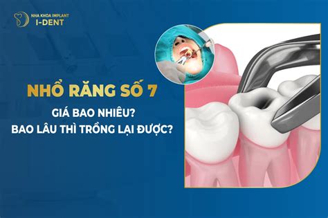 Nhổ răng số 7 bao lâu thì lành Tất cả những điều bạn cần biết