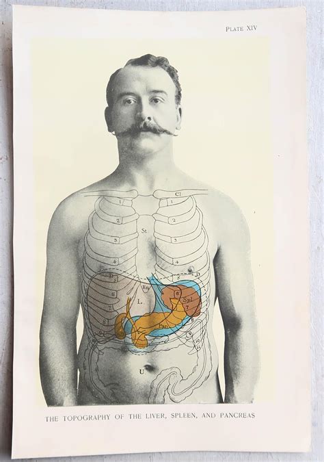 Original Vintage Medical Print Liver Spleen And Pancreas Circa 1900