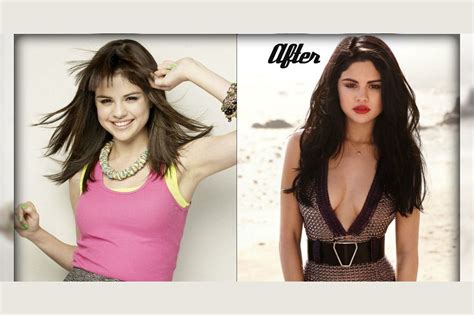 Before And After Celebrities