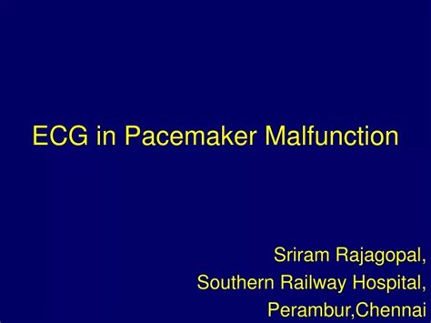 Ppt Ecg In Pacemaker Malfunction Powerpoint Presentation Free