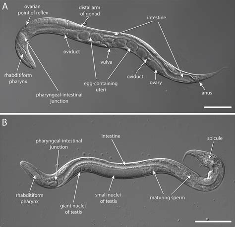 Strongyloides Stercoralis Introduction