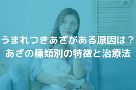 うまれつきあざがある原因は？あざの種類別の特徴と治療法を医師がわかりやすく解説 皮膚のトラブル解決のための情報メディア 皮膚科medi