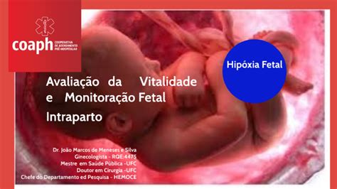 Avaliação da Vitalidade e Monitoração Fetal Intraparto by Ligia Silva