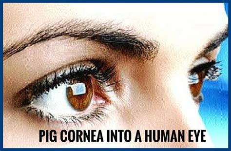 Pig Eye Surface Into A Human Eye Pgurus