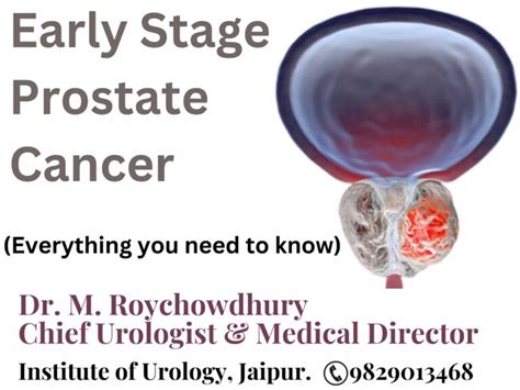 RADIOTHERAPY FOR PROSTATE CANCER - Institute of Urology