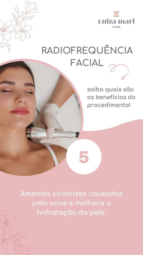 Benef Cios Da Radiofrequ Ncia Facial By Studio Luiza Mari Tratamento