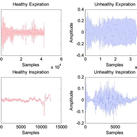 Multifractal Wavelet Leaders First Cumulant Boxplots For Both