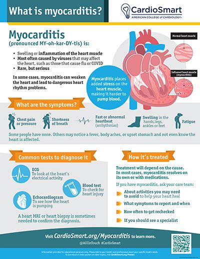 Myocarditis What Is Myocarditis Infographic Cardiosmart