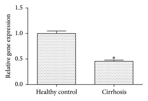 Lincrna P21 Is Downregulated In Tgf β1 Treated Hscs And Human Liver Download Scientific Diagram