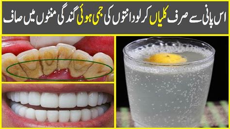 Mouth Wash To Remove Plague From Teeth In Minutes Youtube