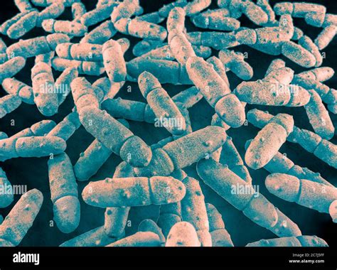 Illustration Of Klebsiella Pneumoniae Bacteria K Pneumoniae Are Gram