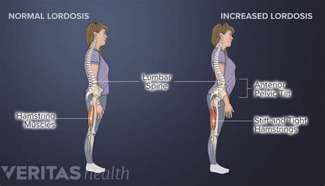 Understanding Lower Back Anatomy Spine Health