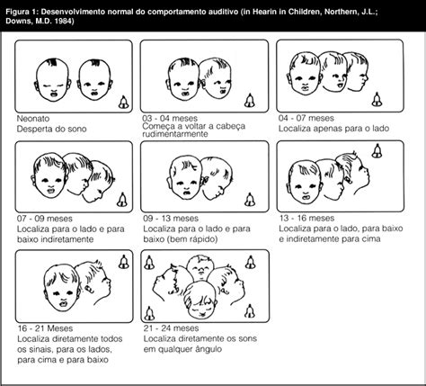 De Acordo Com Almeida 2014 O Desenvolvimento Da Percepção Auditiva - Saúde Auditiva Infantil: Desenvolvimento Auditivo Infantil