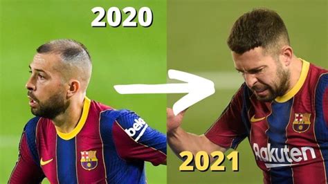 El Impactante Antes Y Despu S De Jordi Alba Tras Su Injerto Capilar