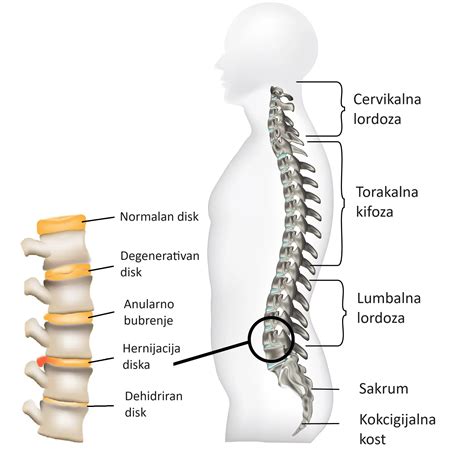 Diskus Hernija Novi Beograd Profizikal