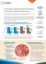 Udrażnianie zatok metodą XprESS system MML Centrum Leczenia Zatok