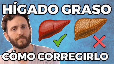 Como Limpiar El H Gado Naturalmente H Gado Graso Youtube