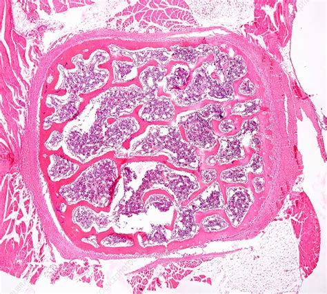 Spongy Bone Histology