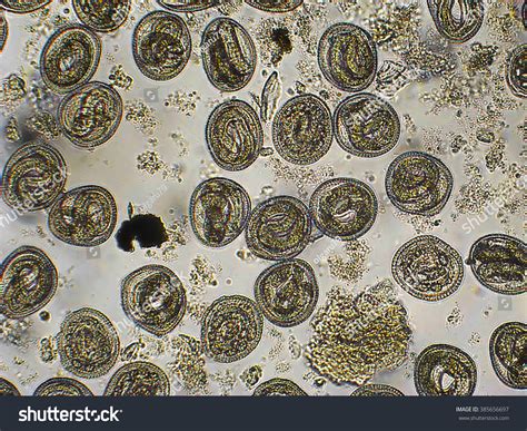 Toxocara Cati L2 Larvae Eggs Microscope Stock Photo (Edit Now) 385656697