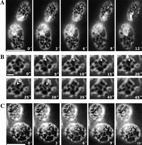 Mutants With Conditional Defects In Vesicular Transport Between The ER