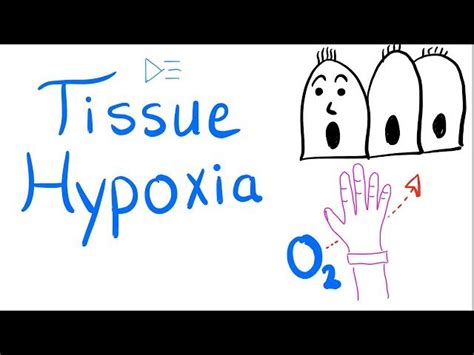 Free Course: Tissue Hypoxia - Respiratory Physiology - Pulmonary ...