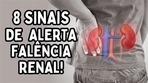 Falencia Dos Rins Sintomas - PROBLEMAS NOS RINS? SINAIS DE FALÊNCIA RENAL QUE VOCÊ NÃO SABIA | Dr ...