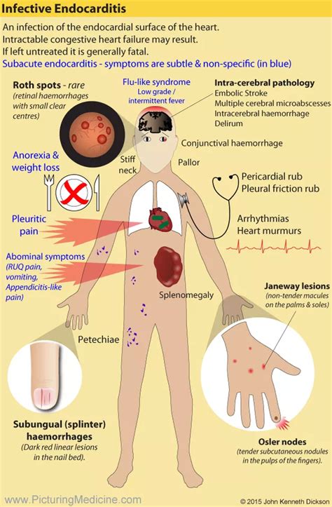 Picturing Medicine Signs Symptoms Of Disease Nursing Study Guide