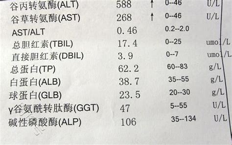 总胆红素和间接胆红素高是啥原因有啥危害早了解早受益 心脑血管频道 东方养生