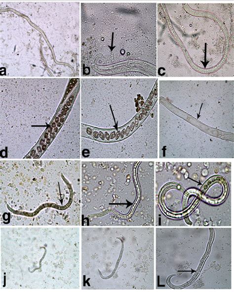 Capillaria Philippinensis Egg