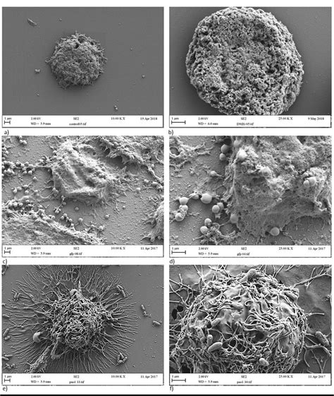 Macrophage Engulfing Bacteria Sem