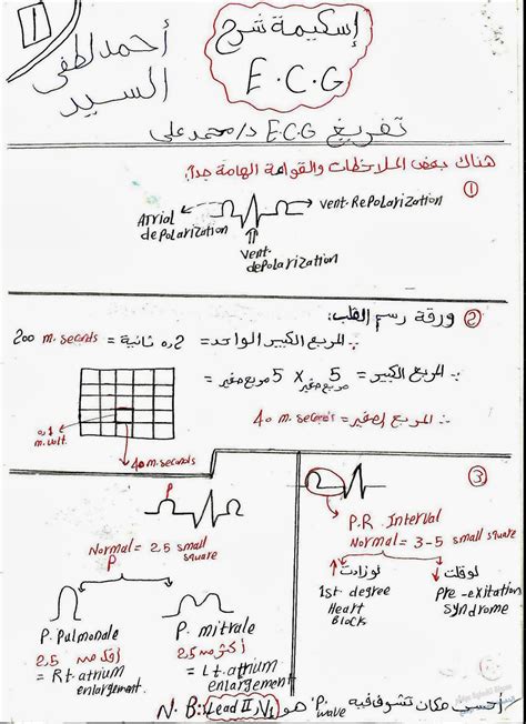 طريقة قراءة رسم القلب بسهولة Ecg بالصور