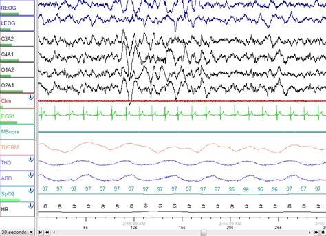 Sleep Medicine Encyclopedia MDPI